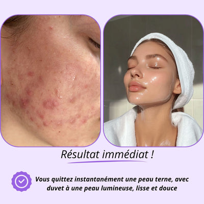SCULPTEUR FACIAL sonic